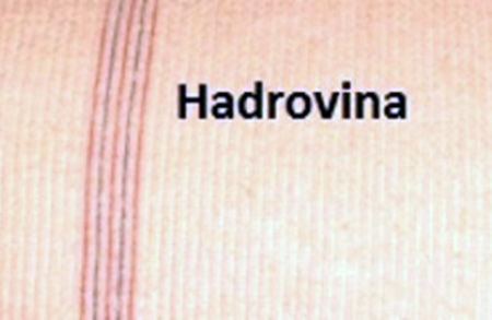 Hadrovina Miss 50 cm